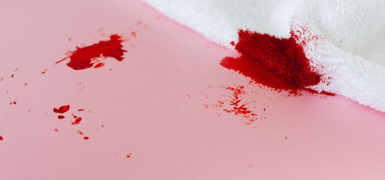 Kan lekesi nasıl çıkar?